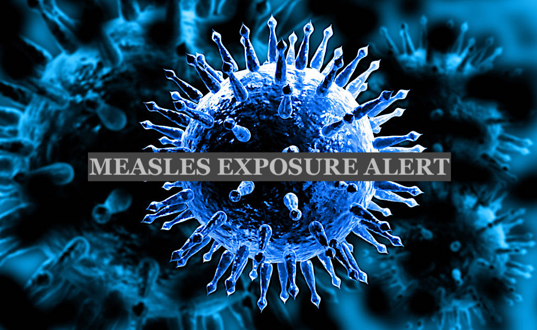 Image for display with article titled El Dorado County Health Officials Issue Measles Exposure Warning