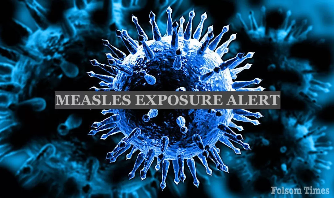 El Dorado County health officials issue measles exposure warning 